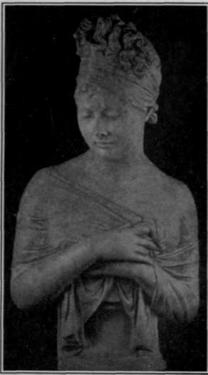 Fig. 65. Front Lighting (Flatness).
