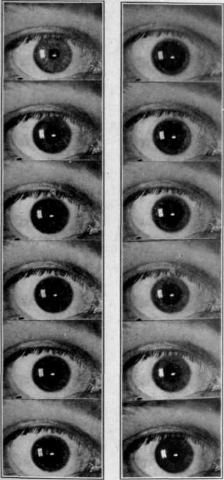 Fig. 7. Iris Opening and Closing.