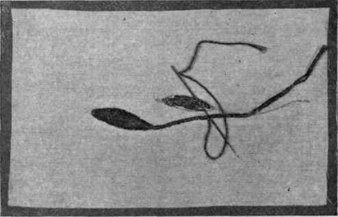 Fig. 258. Laid or satin stitch, showing padding, finished leaf and working stem.