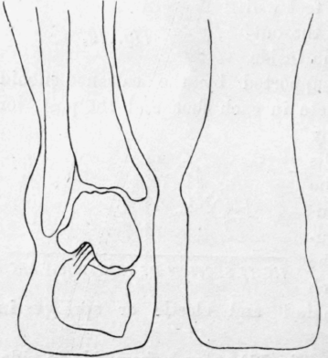Fig. 14