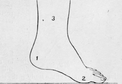 Fig. 30.