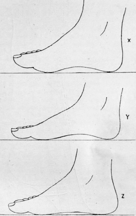 Fig 41
