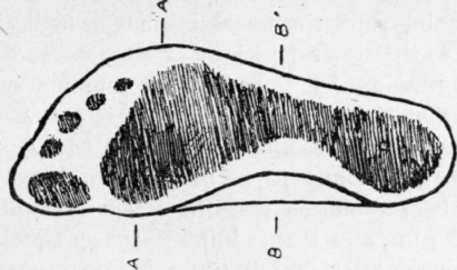 Fig 49