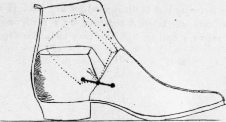 Fig 86