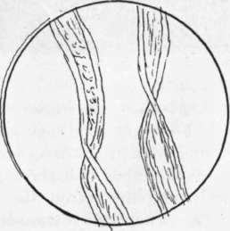 Fig. 8. Cotton fibers magnified.