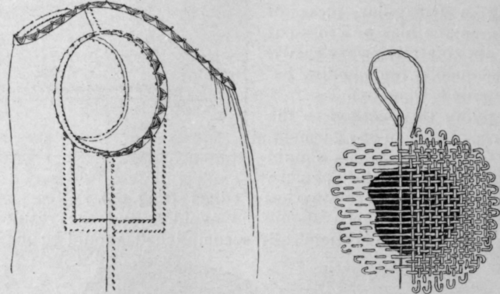 Method 121