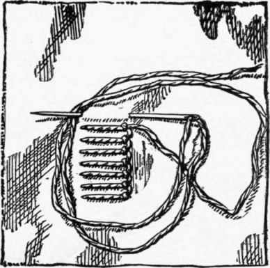 XXII-Fastenings-78