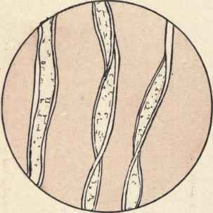 How Can You Recognize The Fiber From Which The Clo 175