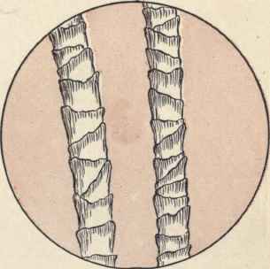 How Can You Recognize The Fiber From Which The Clo 176