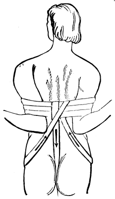 Bleeding From The Upper Arm Art Brachialis 299 15a