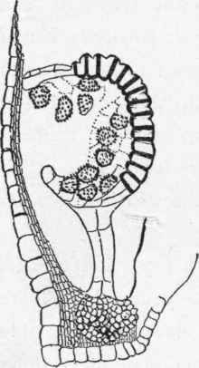 Opening sporangium of a Florida fern (Pteris cretica). (Much magnified).