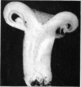 Figure 124. Lactarius resimus