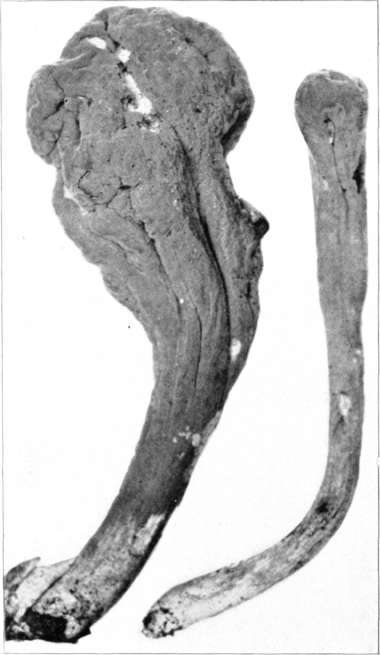 Figure 203. Clavaria pistillaris