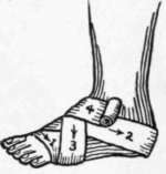Bandages And Bandaging 214