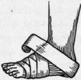 Bandages And Bandaging 215