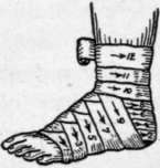 Bandages And Bandaging 217