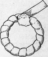 Wadding Ring, to Relieve Pressure