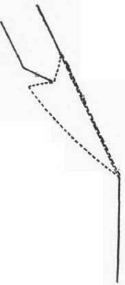 Diagram I. The dotted line indicates how to cut the facing of the collar (see p. 758)