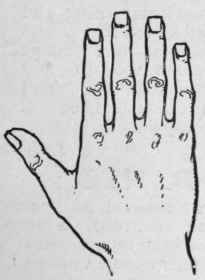 Fig. 2. The Square Hand denotes