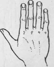 Fig. 3. The Spatulate Hand denotes a love of independence, restlessness, and originality. Inventors and travellers usually possess this type of hand.