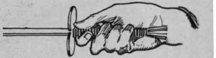 Fig. 4. Hand in supination that is, with the palm uppermost
