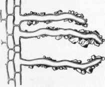 Root Hairs or Absorptive Cells of Pentstemon with adherent particles of earth.