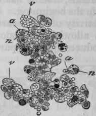 Fig. 171. Section of lung, hardened in osmic acid, from guinea pig poisoned by arsenious acid. The capillaries, v, project into the cavities of the alveoli, and are full of red blood corpuscles.