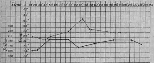 Fig. 216. Shows the action of digitalis when given after the temperature has already risen. At the 30th minute the warming was begun; at the 100th minute .