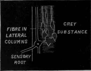 Fig. 57. Diagram to show the effect of chloroform, chloral, and other anaesthetics on conduction of