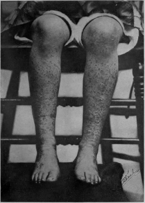 Fig. 62.