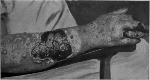 Fig. 66.