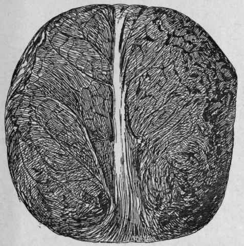 Fig. 234.   Turkey Opium. Slightly reduced. {Pharmaceutical Journal.)