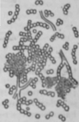 Fig. 8.   Achorion