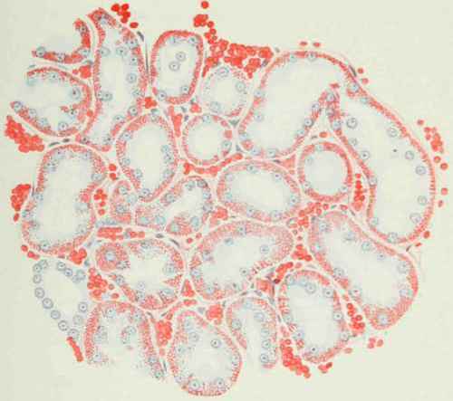 Kidney of rat fed on a bread and milk diet.