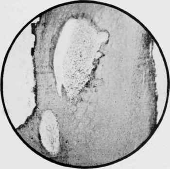 Longitudinal section of the Shaft of the Radius of an Infant aet.