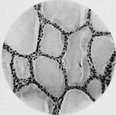 Thyroid Gland of Wild Rat.