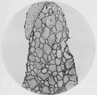 Thyroid Gland of Wild Rat.