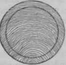 Manence Of Form And Combination Of Tbi Woods Secti 10012
