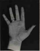 CONIC FINGER TIPS