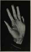 DEFICIENT MOUNT AND FINGER OF MERCURY