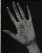 POINTED FINGER TIPS