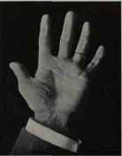 ROBERT F1TZSIMMONS, WELL KNOWN PUGILIST