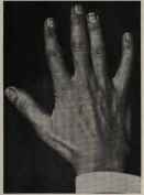 SQUARE FINGER TIPS