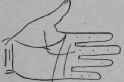 A Line Cutting The Root Of The Second Finger 339
