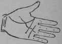 A Line Cutting The Root Of The Second Finger 341