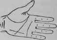 B In Combination With Other Indications 455
