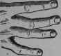 D The Spatulate Fingers 24