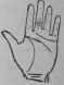 Deafness 1148
