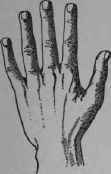 IV The Necessary Hand 35