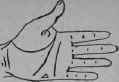 Laryngitis 158